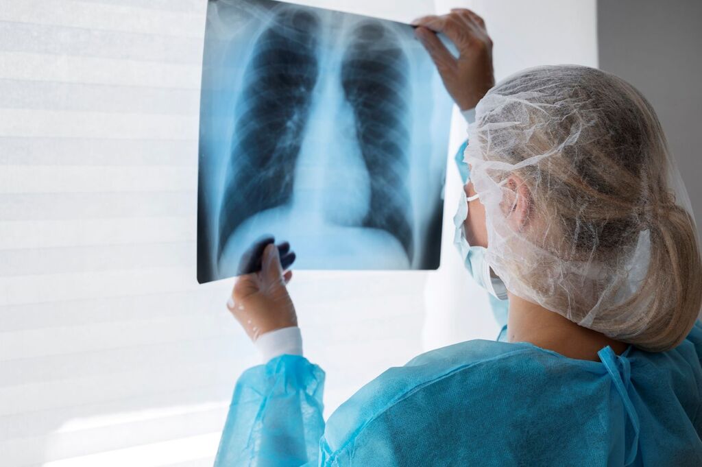 TUBERCULOSE: SAÚDE SC REFORÇA A IMPORTÂNCIA DO DIAGNÓSTICO PRECOCE E TRATAMENTO ADEQUADO PARA A CURA DA DOENÇA