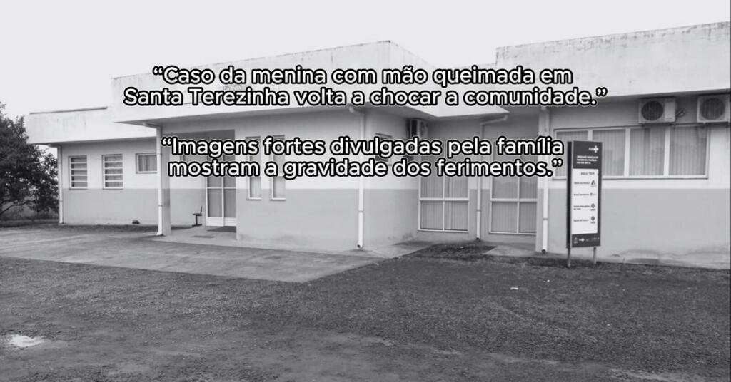 Menina Queima a Mão, Fica Sem Atendimento e Família Divulga VÍDEO