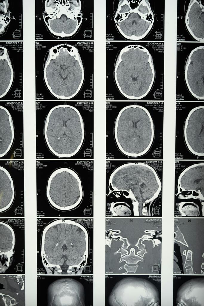 Unipampa promove simpósio sobre neurociência e sistema nervoso