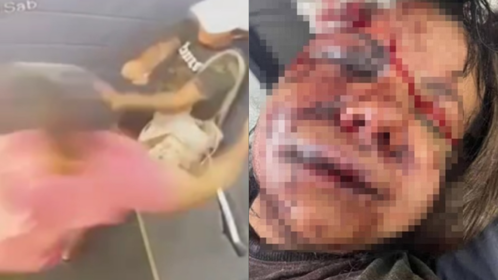 Imagem reprodução redes sociais - Mulher espancada com mais de 60 socos em elevador por ex-jogador de basquete tem rosto desfigurado