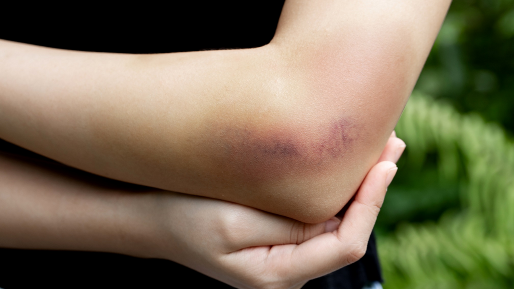 Imagem Adobe Stock - Homem invade casa e é expulso pelo filho após agredir a ex em Imbituba