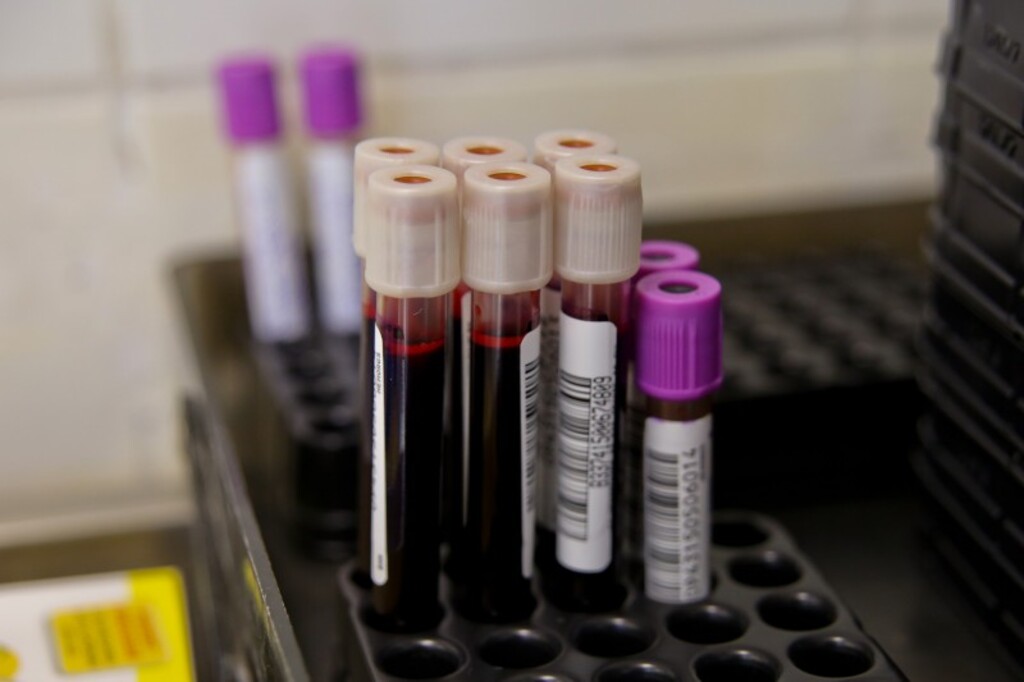 Com estoques baixos, apelo é para que população doe sangue