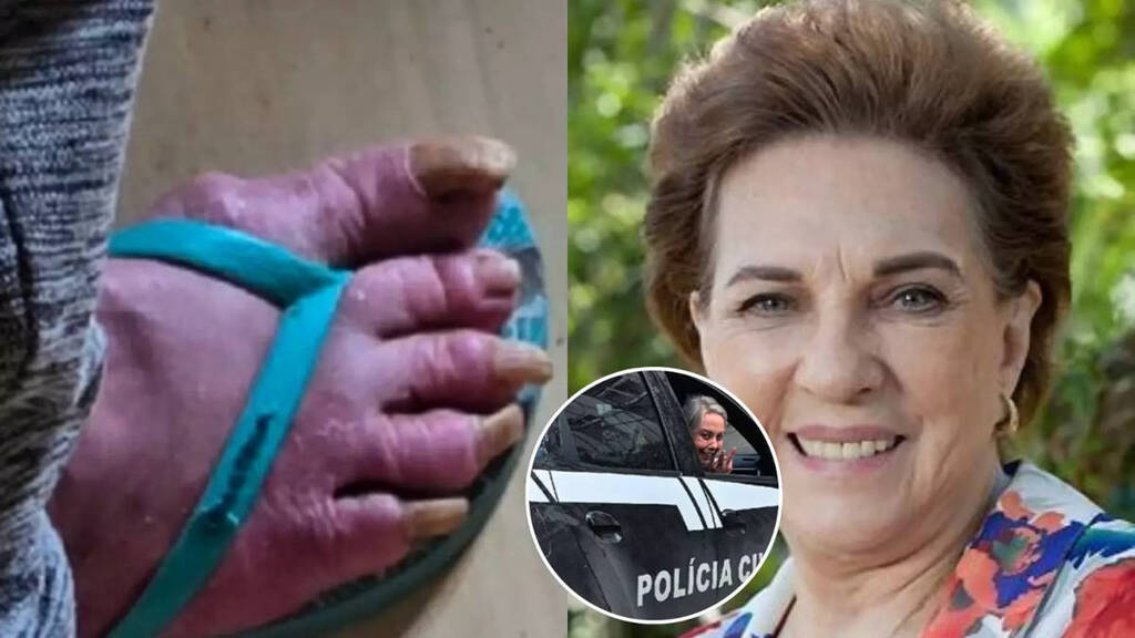 Ex-atriz da Globo é encontrada em situação precária aos 74 anos