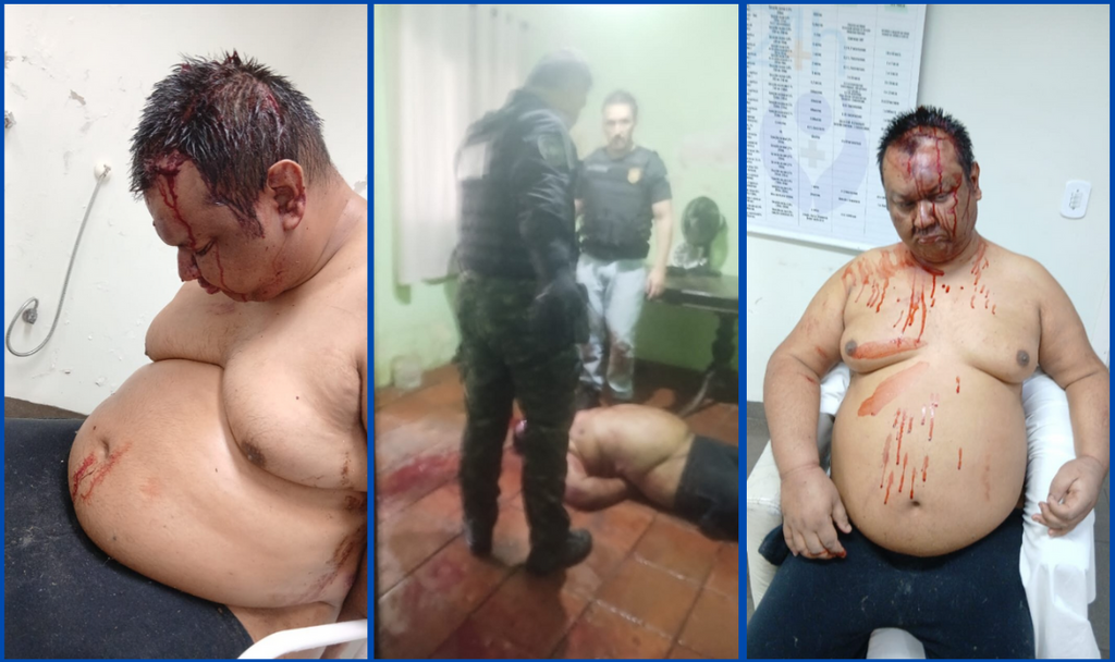 Polícia Civil espanca homem com esquizofrenia