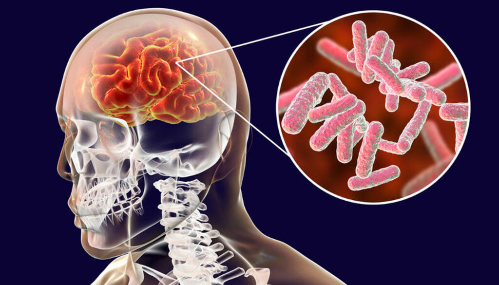 Campo Alegre registra segundo caso de meningite bacteriana na região