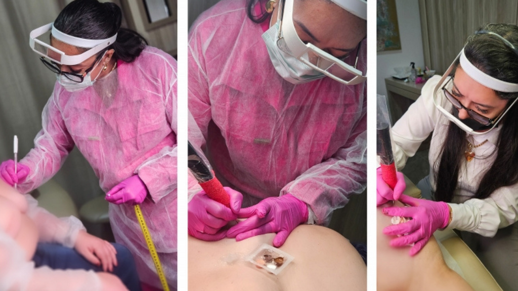 Imagem divulgação - Alesc promove reconstrução gratuita de aréolas para mulheres que venceram o câncer de mama