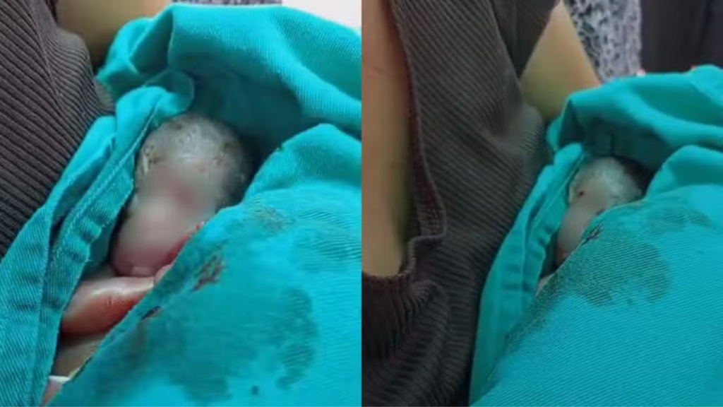 Bebê dado como morto chora dentro do caixão durante sepultamento