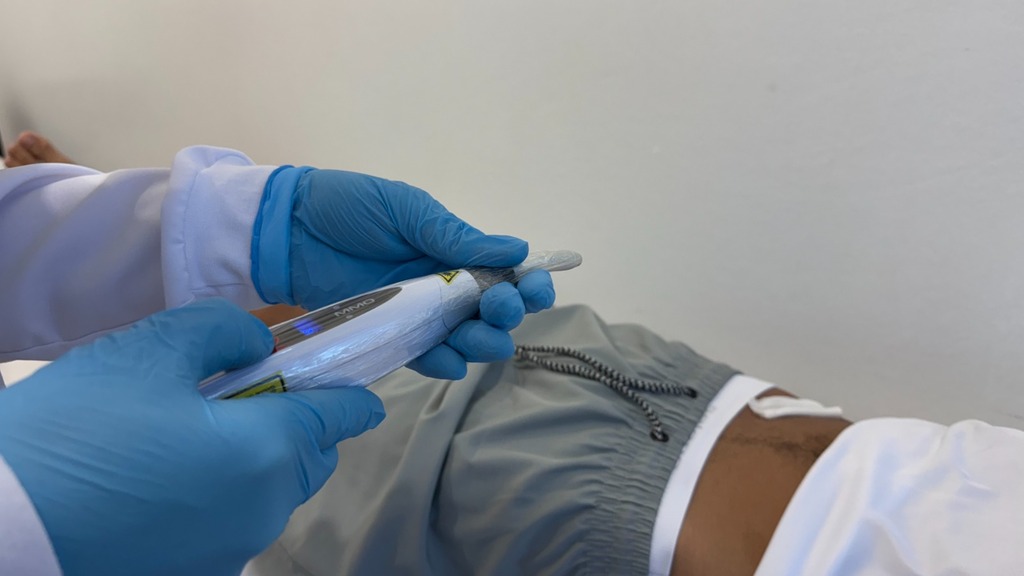 Pinhalzinho utiliza tecnologia a laser para acelerar em até 50% a cicatrização de feridas