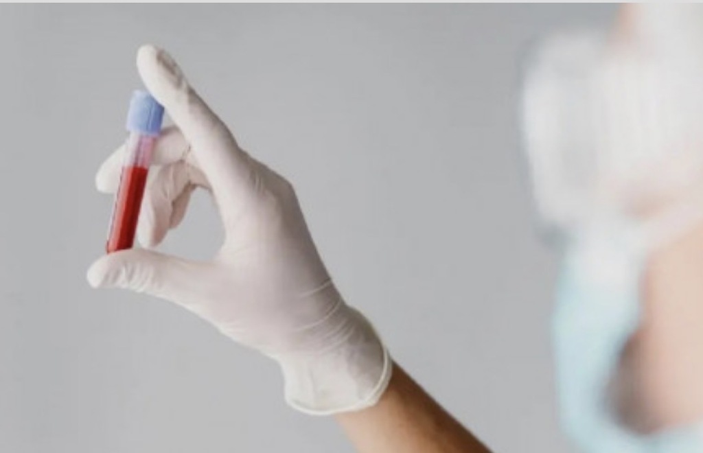 Novo exame de sangue para Alzheimer detecta a doença com precisão de 94,5%