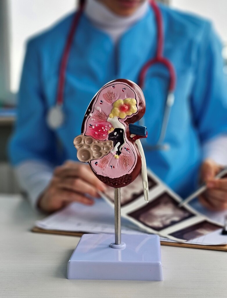 Casos de câncer renal podem aumentar cerca de 80% até 2050 no Brasil e na América Latina