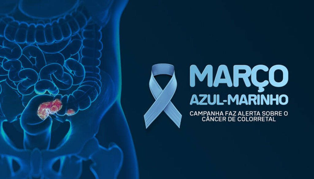 MARÇO AZUL-MARINHO ALERTA PARA PREVENÇÃO DO CÂNCER DE INTESTINO E IMPORTÂNCIA DA COLONOSCOPIA APÓS OS 45 ANOS