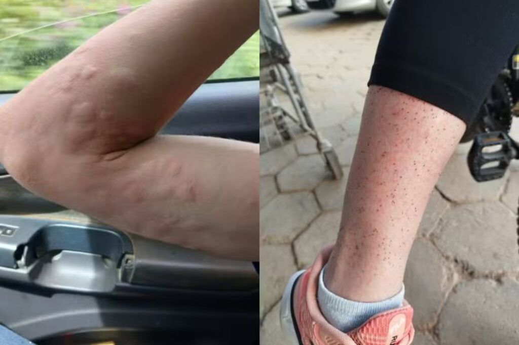 Moradores de Ilhota enfrentam infestação de maruim há anos