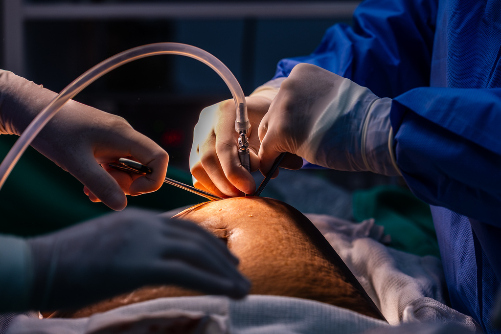 Hospital Bethesda é habilitado para cirurgias bariátricas pelo SUS