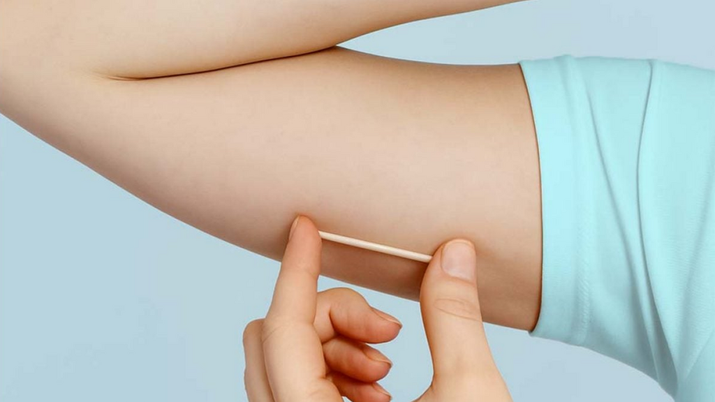 Laguna passa a disponibilizar implante contraceptivo gratuito na rede pública de saúde