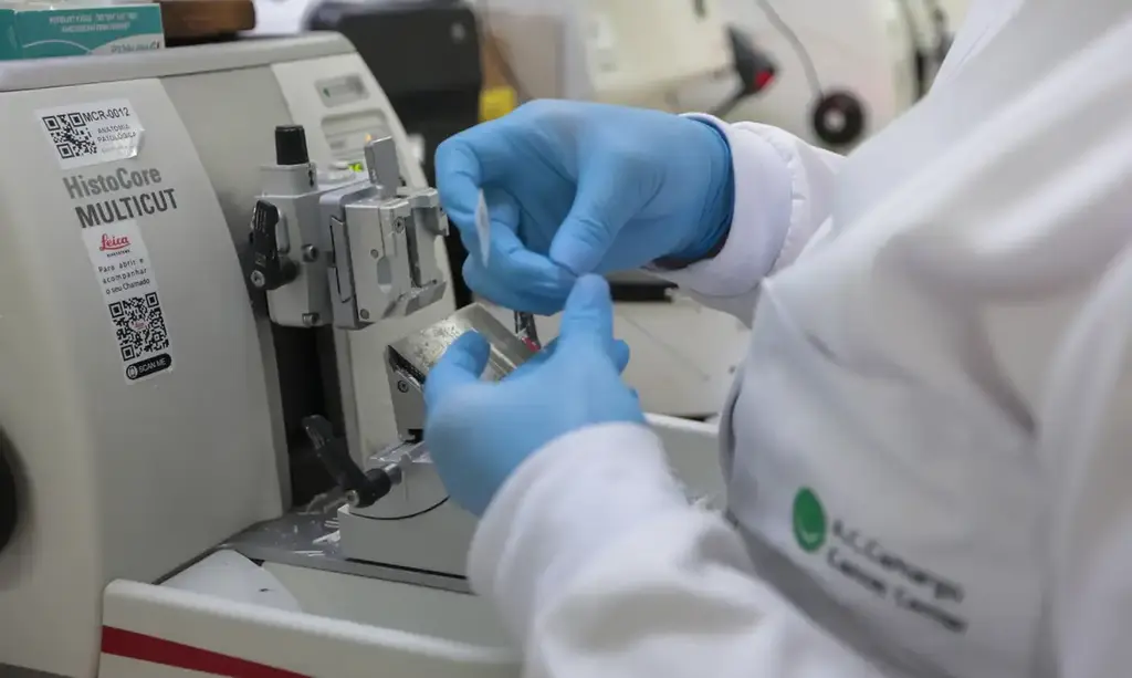 SUS INCLUI NOVA TERAPIA PARA PACIENTES ADULTOS COM LEUCEMIA MIELOIDE