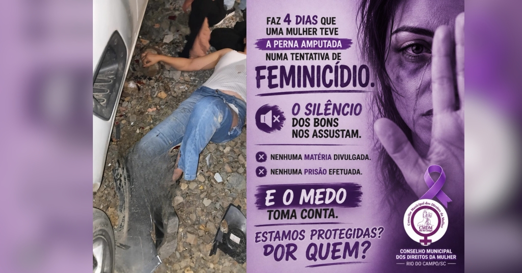 CMDM cobra respostas após caso que deixou mulher com perna amputada em Rio do Campo