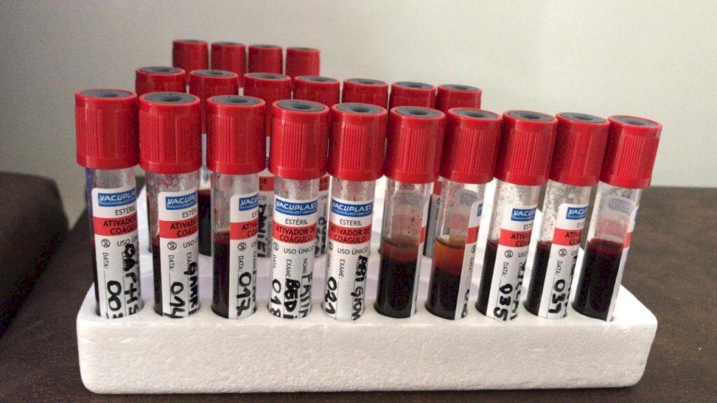 Em duas semanas, 423 pessoas serão testadas