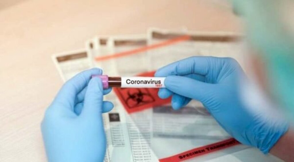 Somente pacientes graves coletarão exames