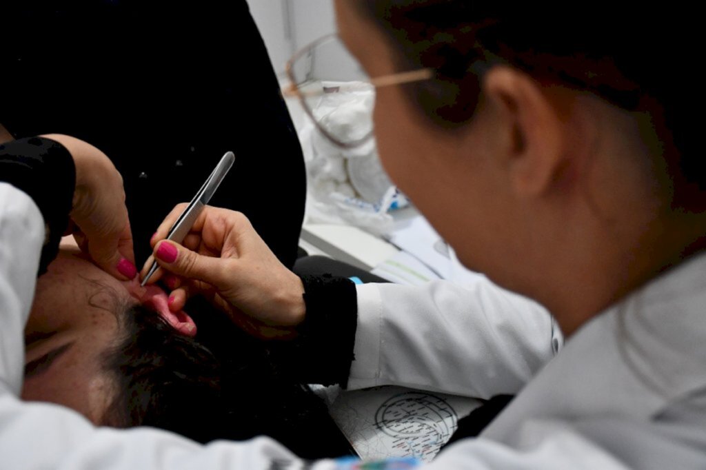 Saúde passa a oferecer Auriculoterapia