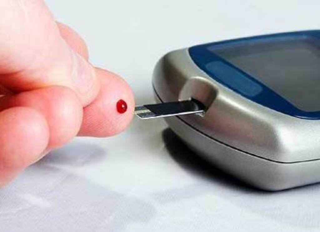 Ilustração - O exame de monitoramento é praticamente indolor