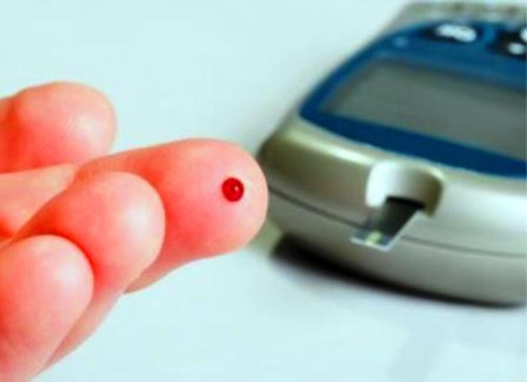 Divulgação da internet - Exame de identificação é simples e rápido