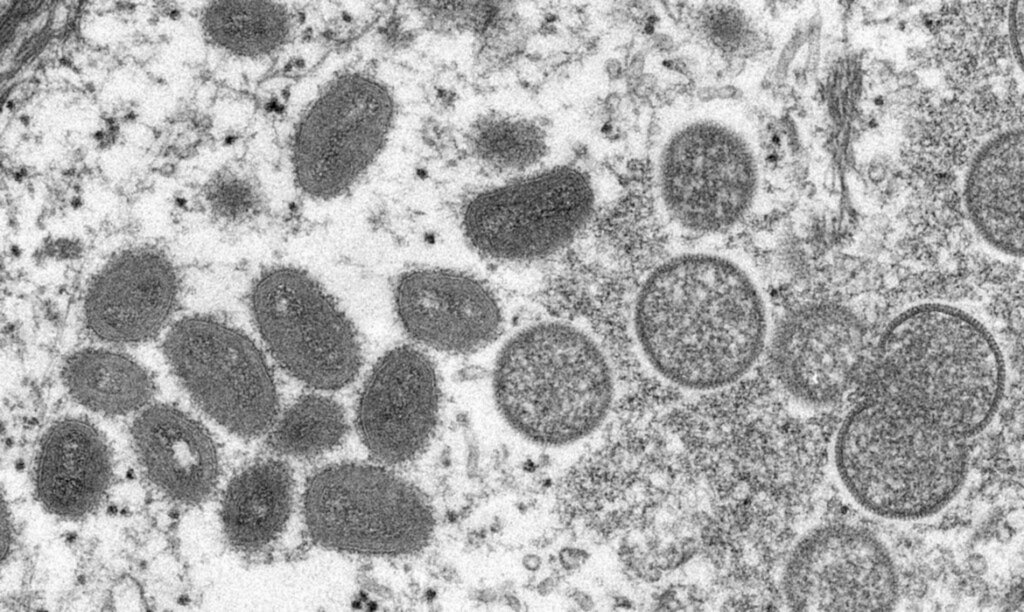 Suspeitas de varíola dos macacos em Santa Catarina são descartadas