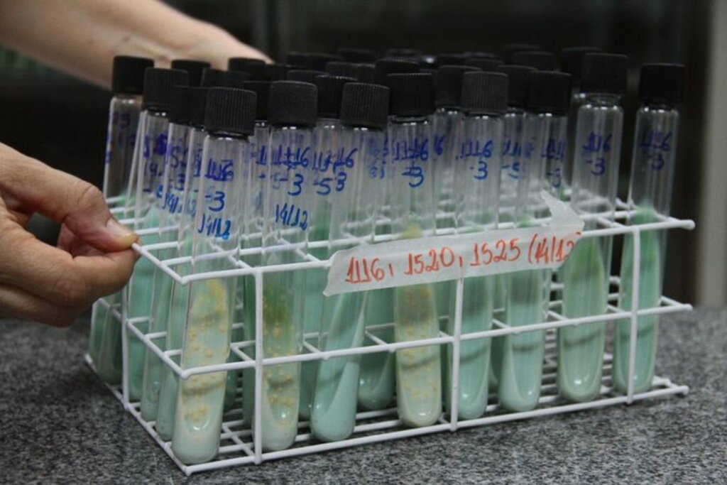 Público pode buscar teste para tuberculose na próxima quinta-feira