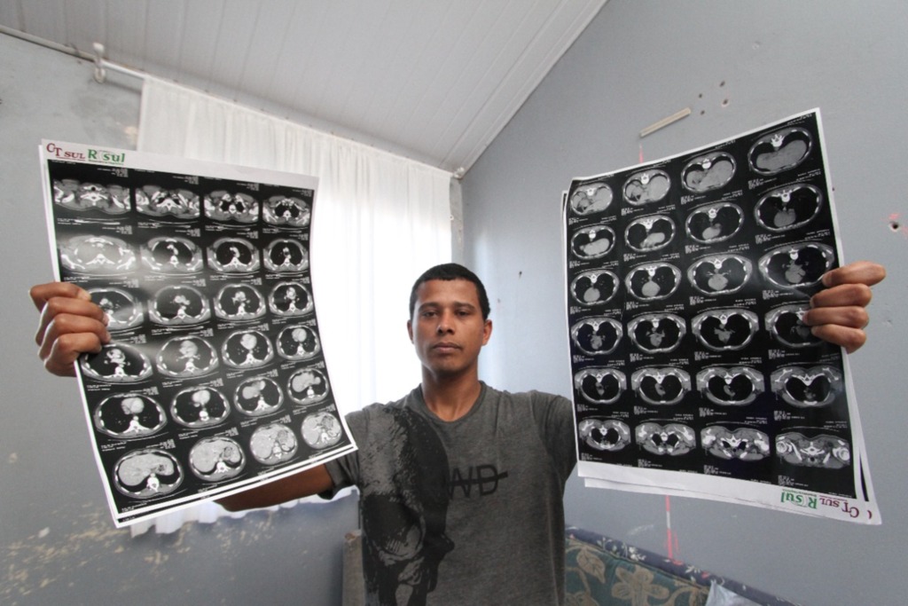 Falta de contraste impacta realização de exames médicos em Pelotas