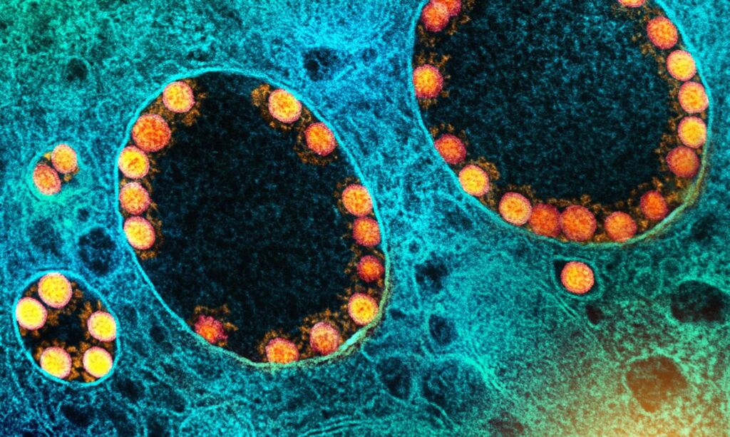 Pesquisa mostra eficácia da vitamina B12 para atenuar Covid-19