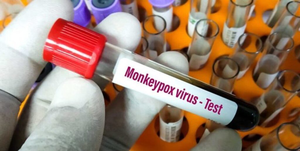Anvisa recebe pedido de registro para teste de varíola dos macacos