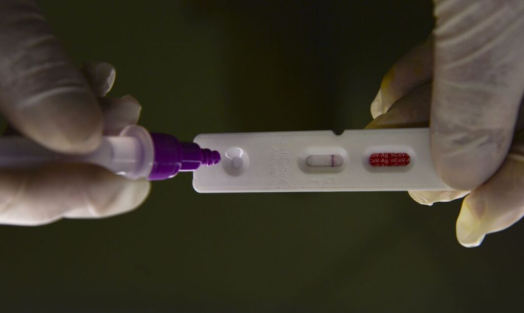 Brasil registra 27.796 casos e 114 mortes em 24 horas