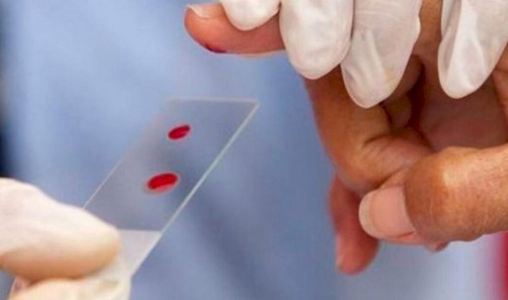 SUS disponibiliza nova opção de tratamento para hemofilia A