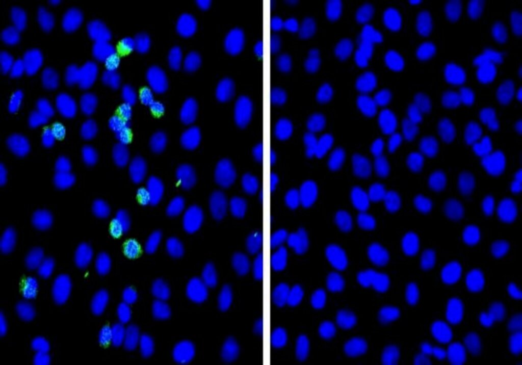 Japoneses identificam proteína que impede replicação da Covid