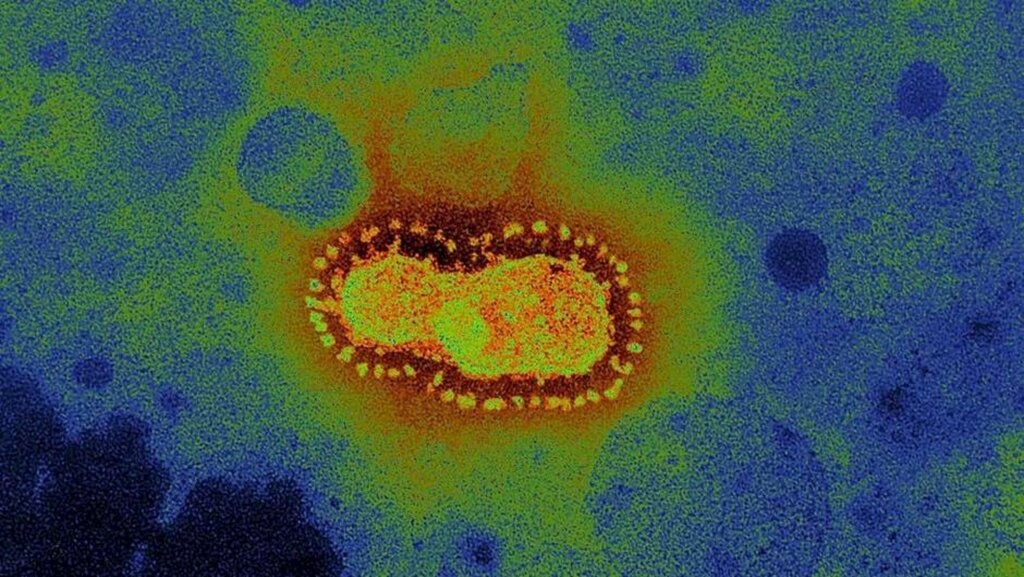 Getty Images / BBC News Brasil - Segundo critérios do Ministério da Saúde, reinfecção deve ser detectada com testes RT-PCR com intervalo de no mínimo 90 dias