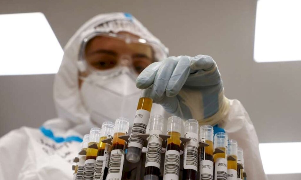Maxim Shemetov - Médica examina testes em um laboratório de hospital temporário para o tratamento de Covid-19 em Moscou