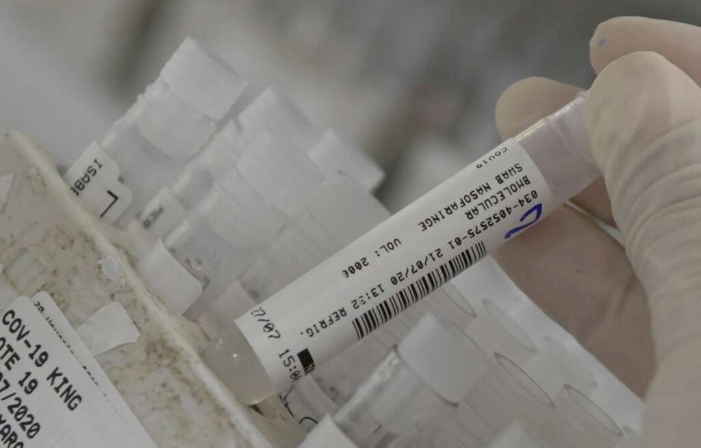 Washington Alves - Funcionário de laboratório que realiza testes RT-PCR para Covid-19 em Vespasiana (MG)