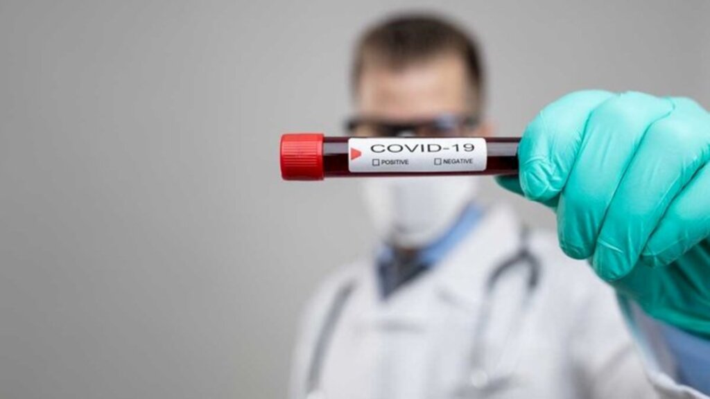 CORONAVÍRUS - Joinville amplia atendimento para testagem de Covid-19 aos assintomáticos