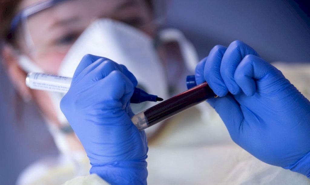 Casos semanais de covid-19 voltam a subir no Brasil