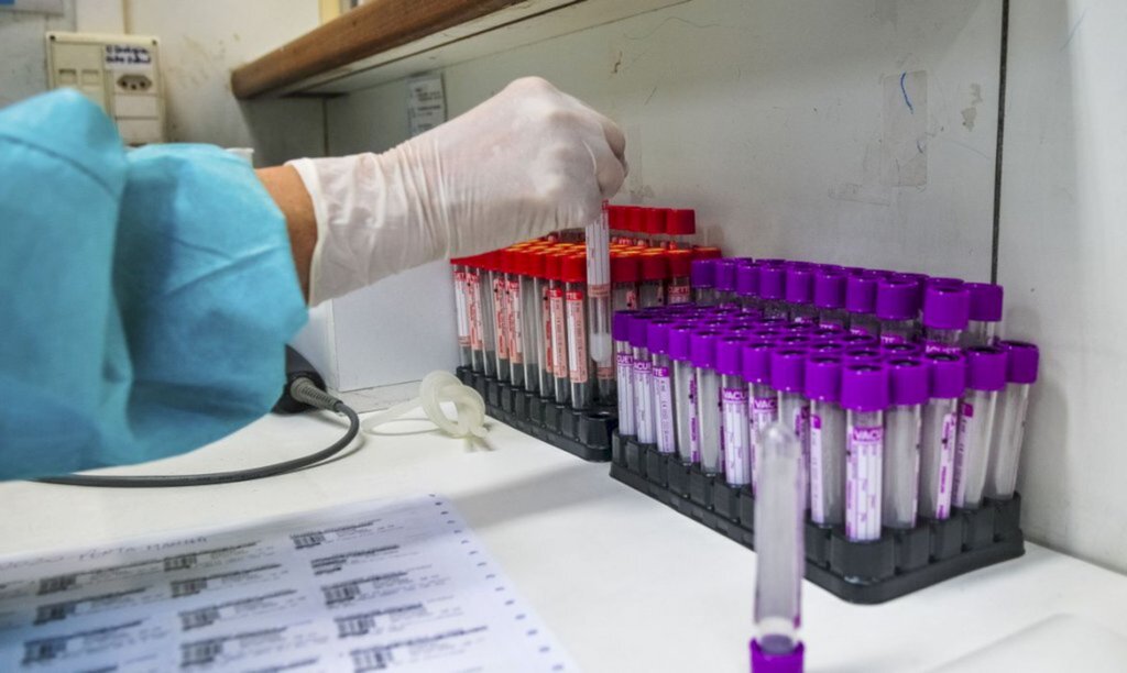 Covid-19: Brasil tem 33,5 mil novos casos e 836 mortes em 24 horas