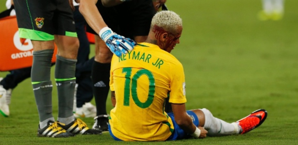 Divulgação - Após levar cotovelada, Neymar deixou o gramado da Arena das Dunas sangrando