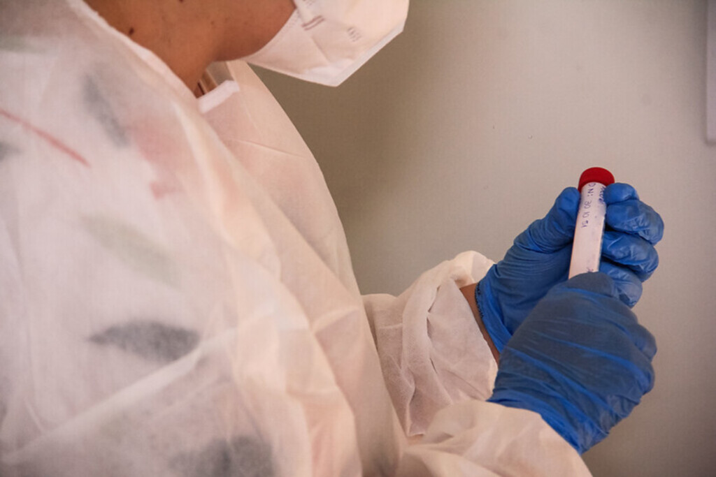 Pelotas aplica mais de 3,4 mil testes de Covid na última semana