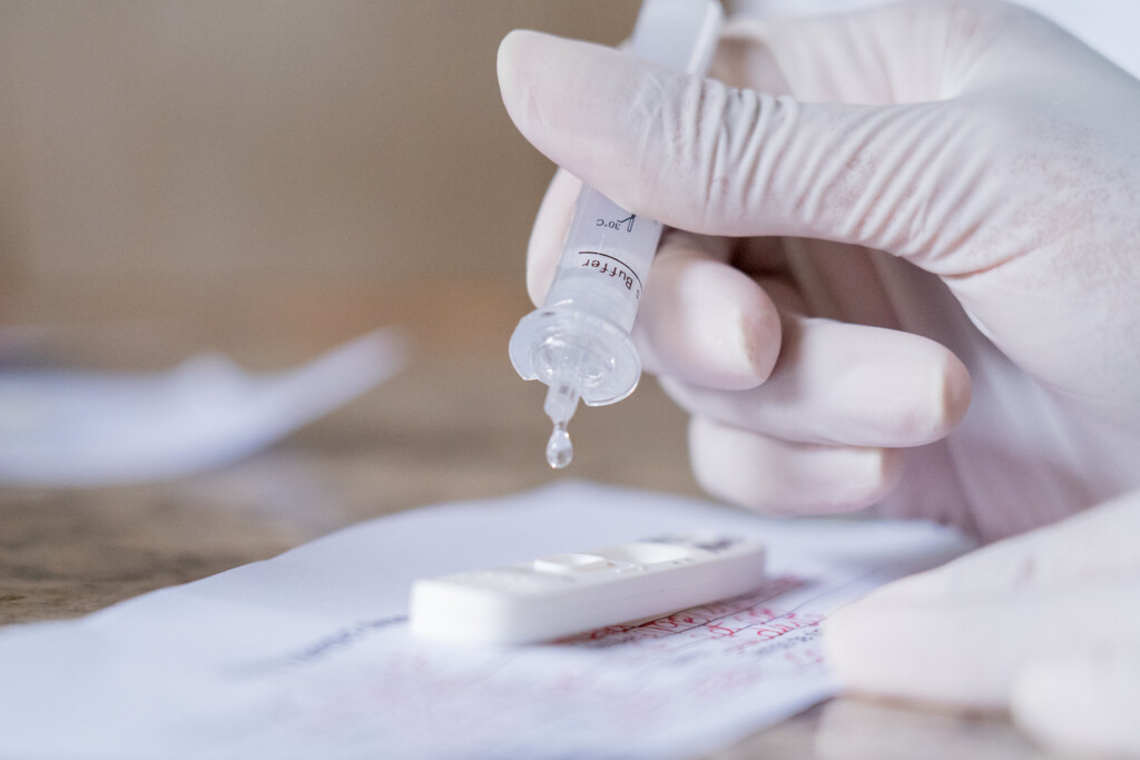 Anvisa pede informações sobre autotestes