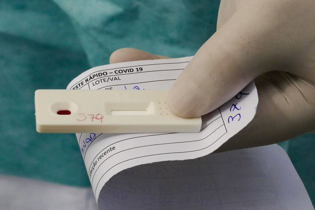 Anvisa aprova novo teste de diagnóstico para Covid-19