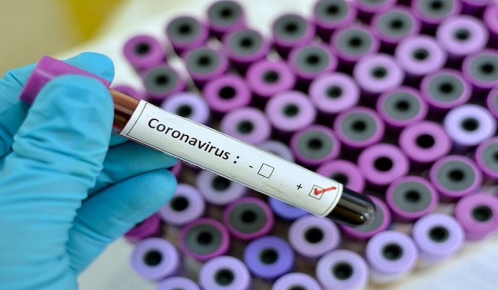 Covid-19: Brasil registra 266 mortes e 12,9 mil casos em 24 horas