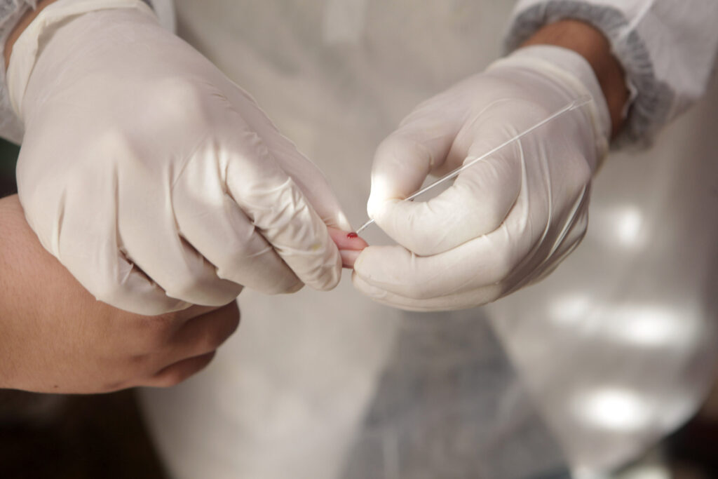 Epicovid19 inicia nova etapa de testes para o coronavírus no RS a partir de sexta-feira