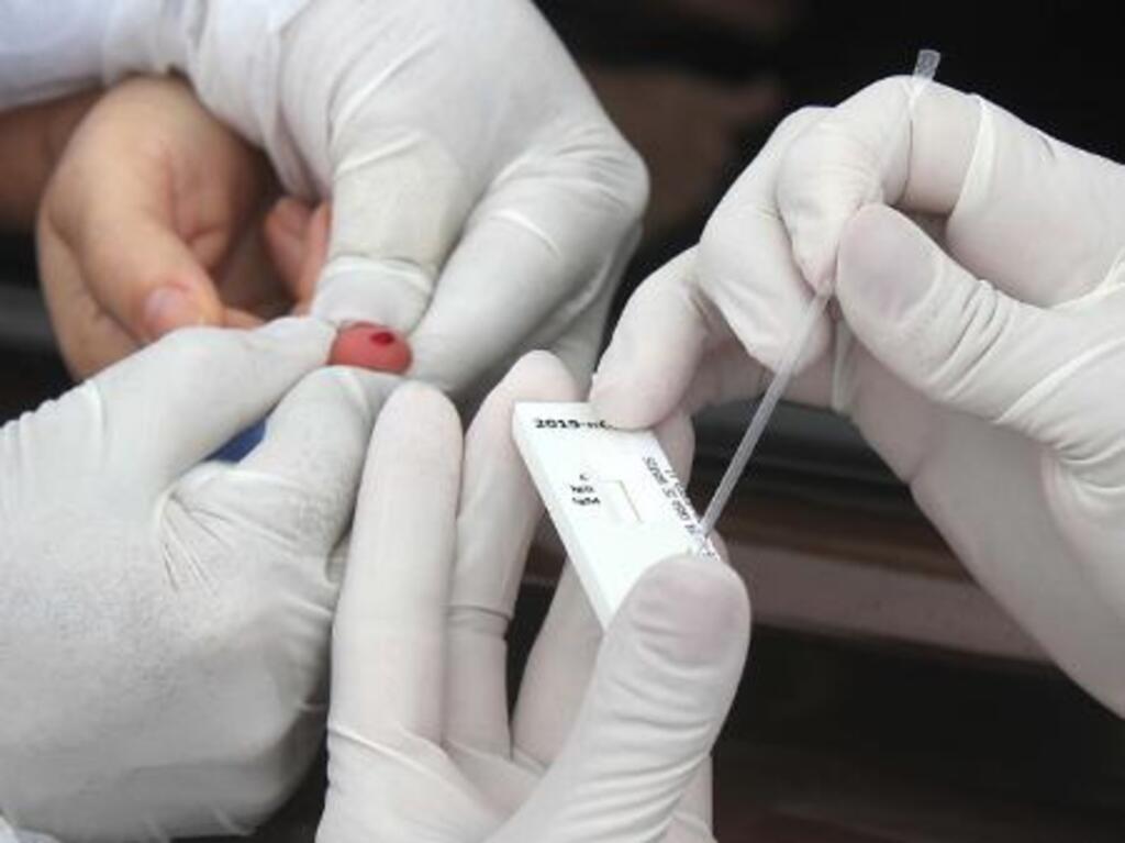 Pelotas registra mais 60 pessoas infectadas pelo vírus da Covid-19
