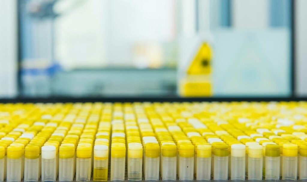 Índia vai exportar doses de vacina para o Brasil nesta sexta