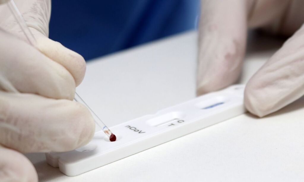 País registra 51 mil novos casos de Covid-19