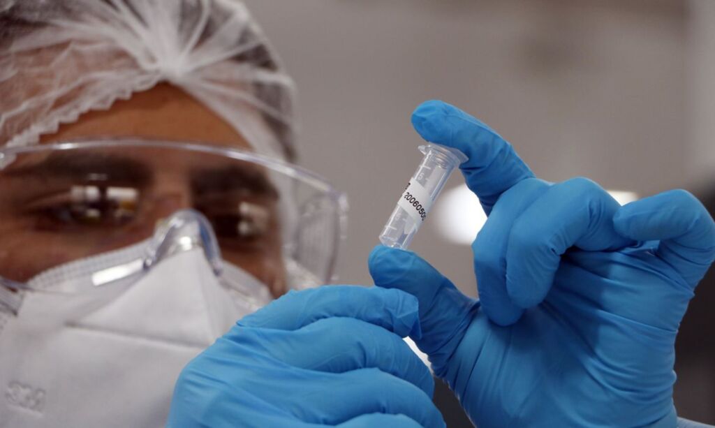 Brasil ultrapassa 177 mil mortes por Covid-19