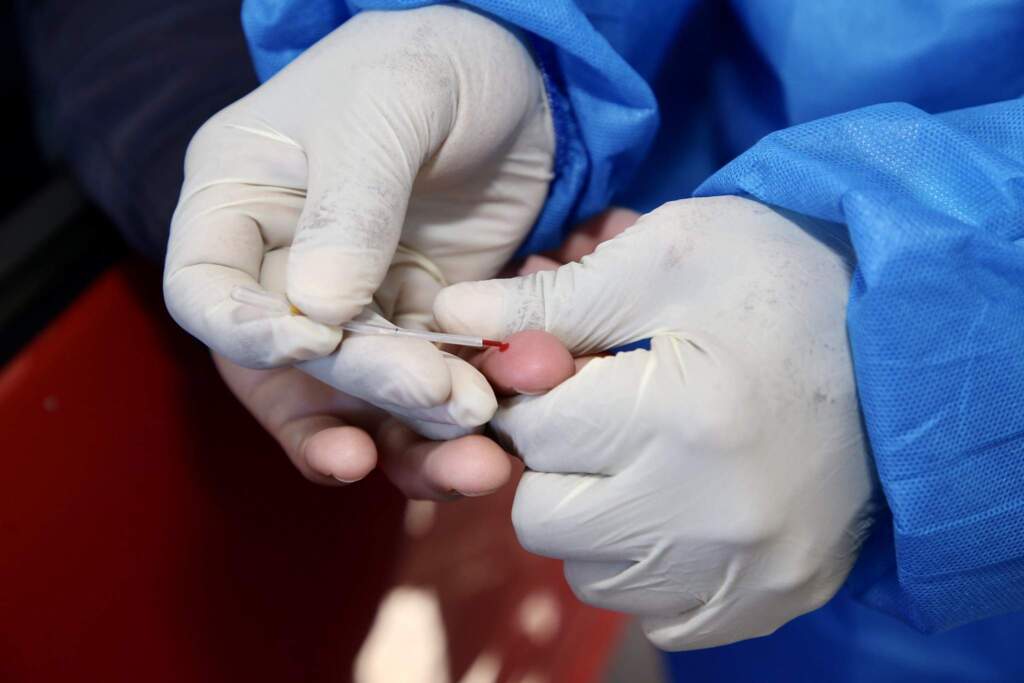 Pelotas bate novo recorde diário de casos de Covid-19